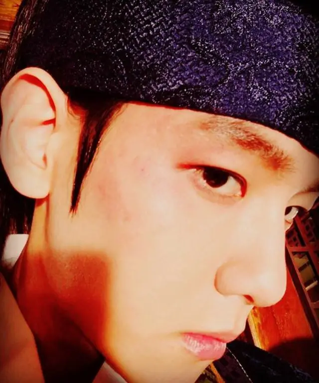 BAEK HYUN（EXO）はカメラに向かってあざができた頬のセルフショットを公開した（提供:OSEN）