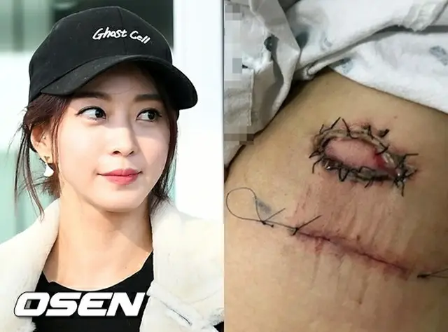 韓国女優ハン・イェスル（35）が医療事故に遭い、現在治療を受けている。（提供:OSEN）
