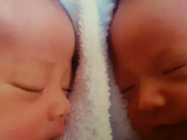 女優イ・ヨンエ、双子の新生児期の写真公開 「どちらが息子、娘でしょうか？」（画像:OSEN）