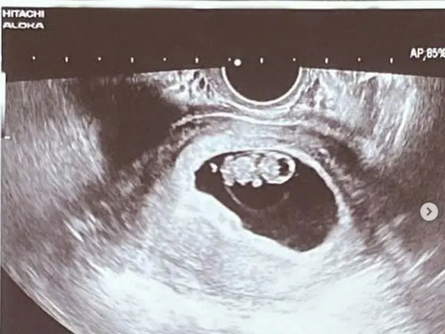 俳優パク・コニョン、2児のパパに！妻の妊娠に感激「待ってるよ」（画像提供:wowkorea）