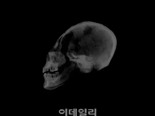 ソウル恩平区の再開発現場で30体余りの遺骨発見＝韓国（画像提供:wowkorea）