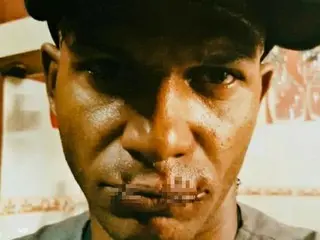 刑務所に入ったキューバの有名ラッパー、自らの唇を縫う…一体なぜ？