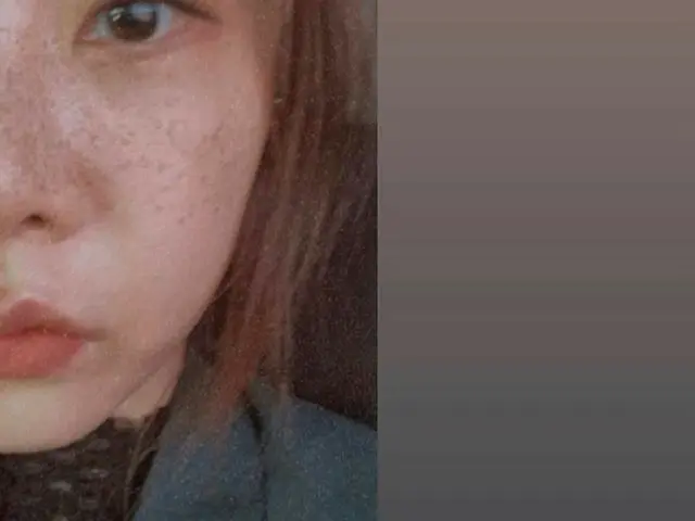 【g公式】GIRL’S DAY _ソジン、Freckles😶   