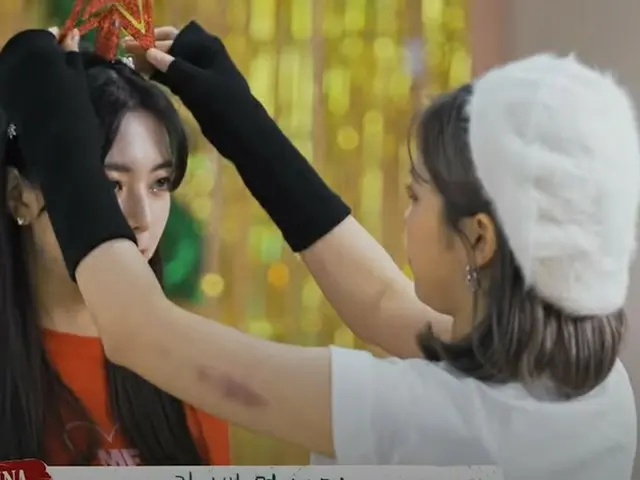 ITZY RYUJINの腕にアザ、、、心配の声