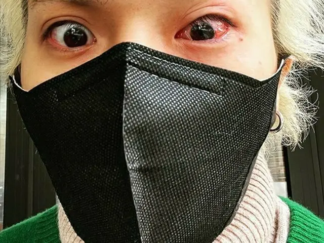 MINO(WINNER)、目が赤く充血した近況を公開