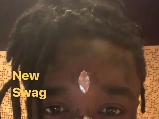 米ラッパーのLil Uzi Vert、おでこに埋めこんだダイヤモンドをライブ中にジャンプして落としたが見つかって出てきたことを明らかに
