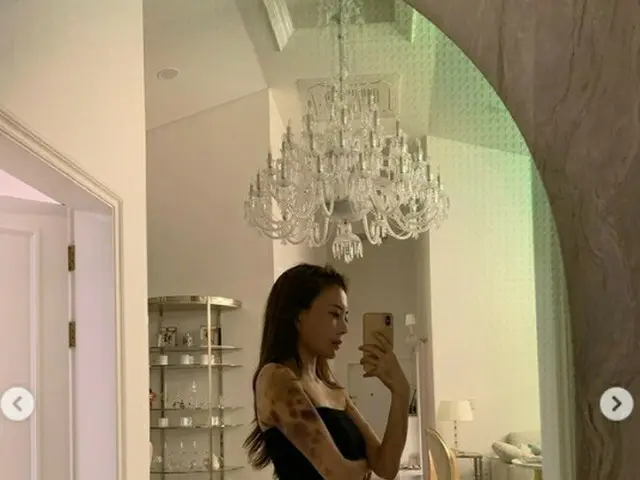 健康増進後に全身青あざの美女ユーチューバーAORI、法的対応を準備していると明かす