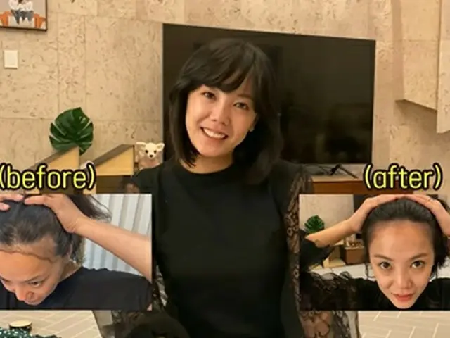 女優コ・ウナ、毛髪移植から3ヶ月経った状態を公開。