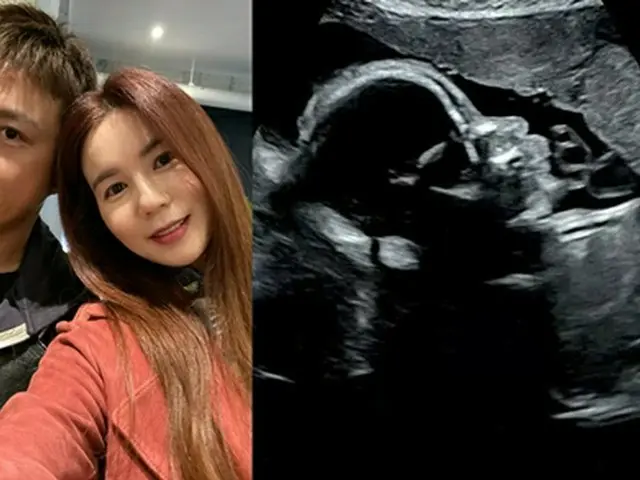 俳優チン・テヒョン、妻で女優のパク・シウンのお腹の中にいる子の心臓が止まってしまったと報告