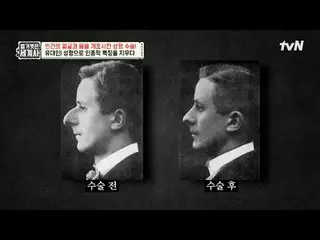テレビでストリーミング:

 2 16回|整形手術は人間の顔と体をどのように改造しましたか？

 〈裸の世界史〉
 [火]夜10時10分tvN放送

 #裸の世