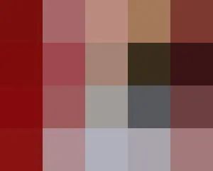 SONYA　ミュージカル公演中足首負傷