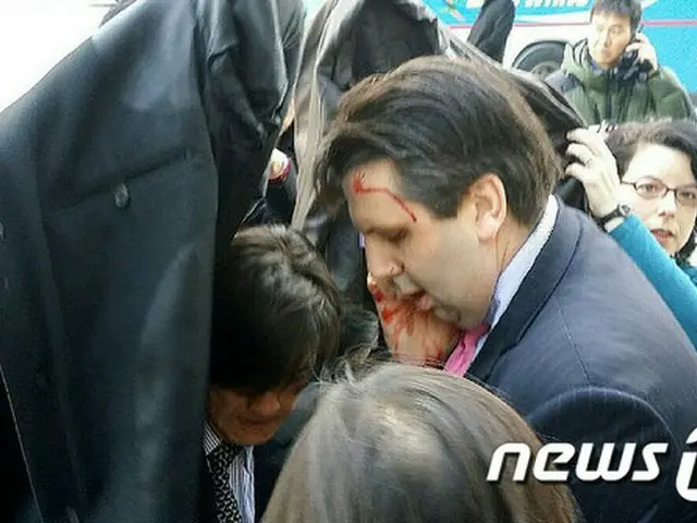 リッパート駐韓米大使、凶器持った男に頬や手首などを切られ大けが＝韓国。
