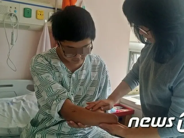 ことし9月11日、大邱（テグ）陸軍第50師団新兵教育隊訓練場で手りゅう弾が爆発する事故が発生し、その事故で右手手首を失ったソン訓練兵（20）が韓国軍当局と深刻な葛藤を繰り広げている。