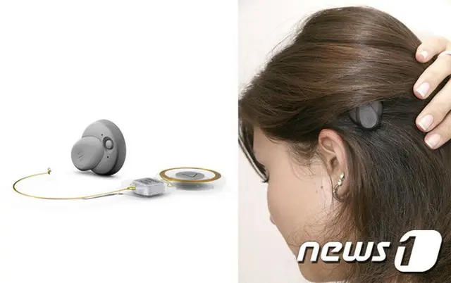 韓国・順天郷大学校富川（プチョン）病院は12日、聴力を補う“人工中耳（補聴器）移植術”を京仁（キョンイン）地域で初めて成功させたことを明らかにした。