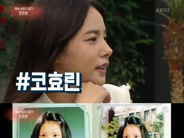 女優ミン・ヒョリンが番組で整形について明かし、注目を集めている。（提供:OSEN）