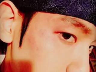 BAEK HYUN（EXO）、あざができたセルフショットを公開し「会いたい」