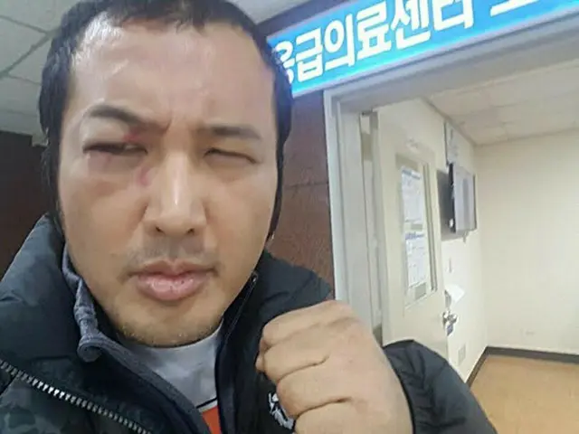 韓国俳優キム・ボソン（50）が手術について悩んでいる。（提供:OSEN）