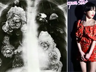 「Brown Eyed Girls」ガイン、インスタの掲示物をすべて削除し謎のレントゲン写真掲載