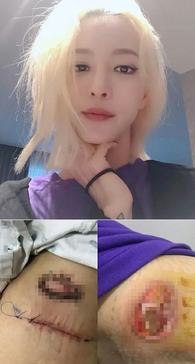 “医療事故”女優ハン・イェスル、ネットユーザーらの応援に「頑張ります」…制度補完を促す国民請願も（提供:OSEN）