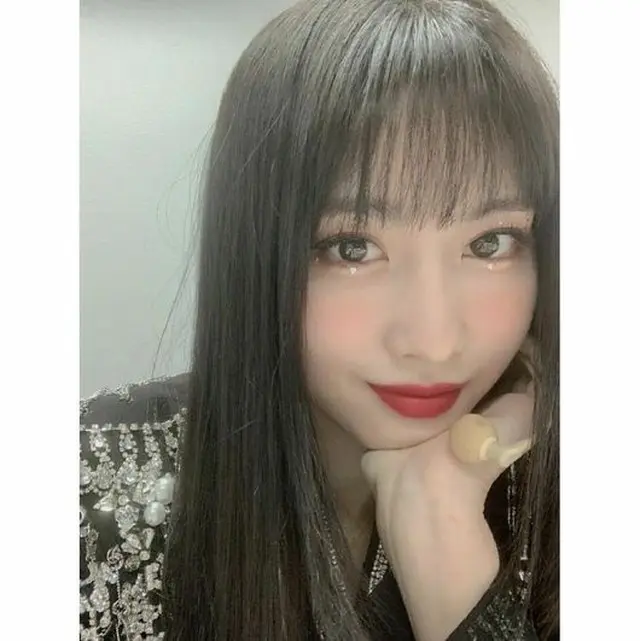 モモ（TWICE）、「親知らず抜いて神経治療しました…歯がとても痛い」（提供:Osen）