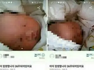 20代シングルマザー、産まれて間もない赤ちゃんを20万ウォン（約1万8千円）でフリマアプリに出品… 赤ちゃんは保護施設へ＝韓国