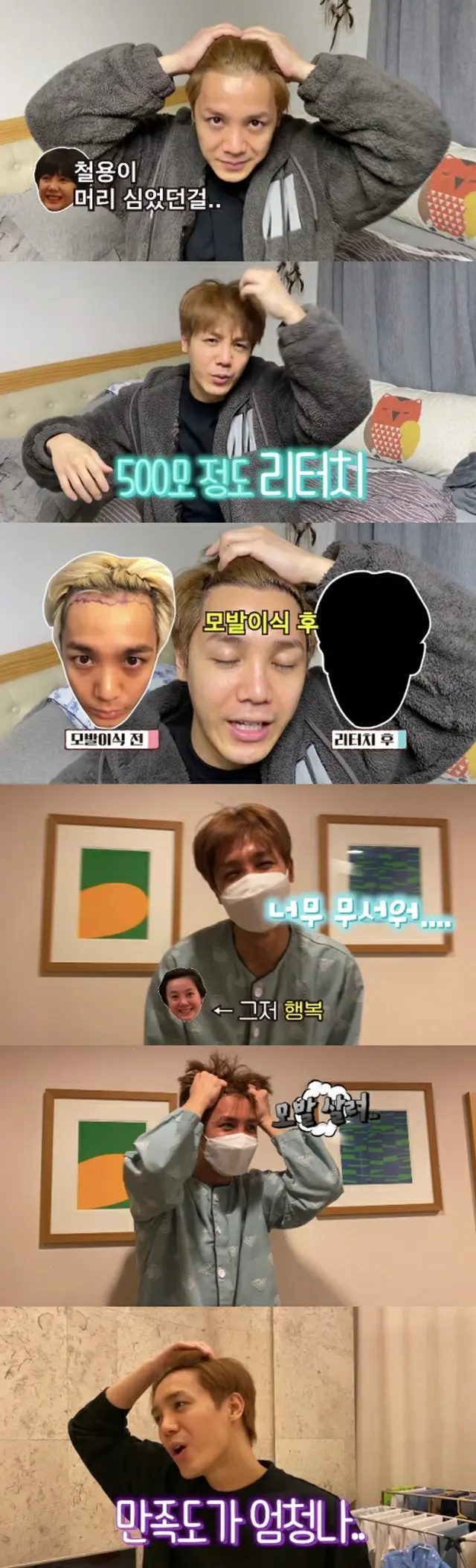 M字脱毛で植毛手術受けていた歌手ミル（MBLAQ）、500本を再び植毛“満足度が高い”（画像提供:wowkorea）