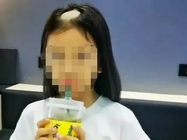 中国で10歳少女が「ネコ飼い始めて1週間で円形脱毛症」に＝韓国報道（画像提供:wowkorea）