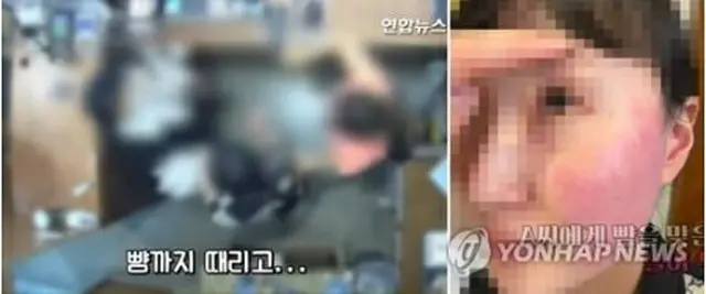 被害に遭った店員側は防犯カメラの映像と殴られた顔の写真を公開した（聯合ニュースＴＶの放送画面）＝（聯合ニュース）