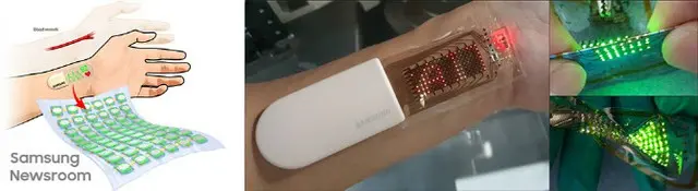 サムスン電子総合技術院による、ストレッチャブル・ヘルスモニタリングシステム（画像提供:wowkorea）
