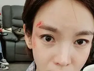 女優チョン・ガウン、「顔ケガしました…」一体どうして？