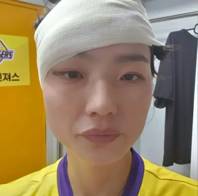女芸人アン・ヨンミ、番組で目を負傷…写真公開に衝撃「心配してくれてありがとう」（画像提供:wowkorea）