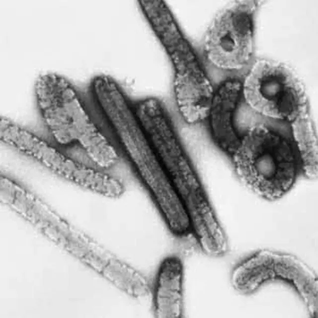 西アフリカのギニアで、死亡者から致死率の高い「マールブルクウイルス」確認（画像提供:wowkorea）