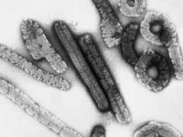 西アフリカのギニアで、死亡者から致死率の高い「マールブルクウイルス」確認（画像提供:wowkorea）