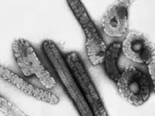 西アフリカのギニアで、死亡者から致死率の高い「マールブルクウイルス」確認