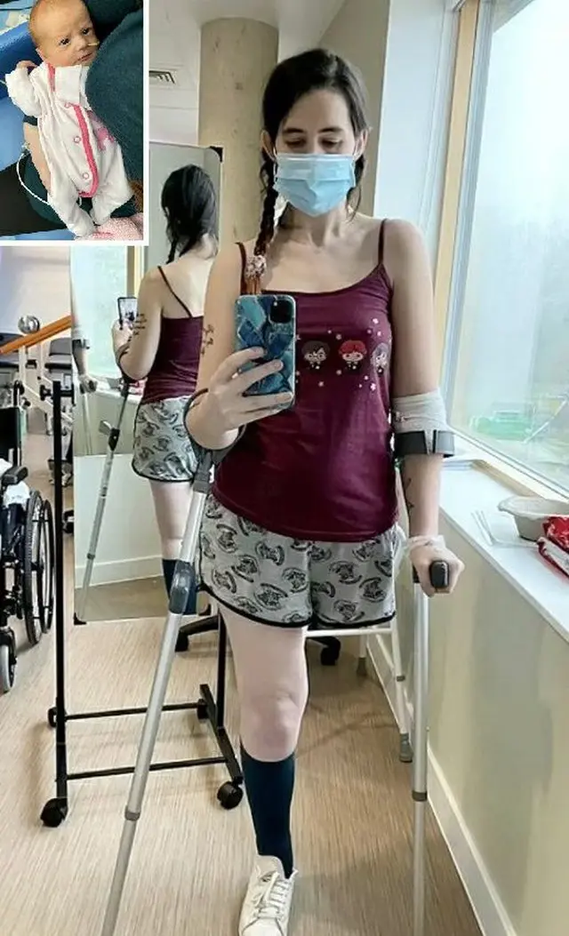 「お腹の中の赤ちゃんを失いたくない」…英国人女性が抗がん治療をあきらめて片足を切断した母性愛（画像提供:wowkorea）