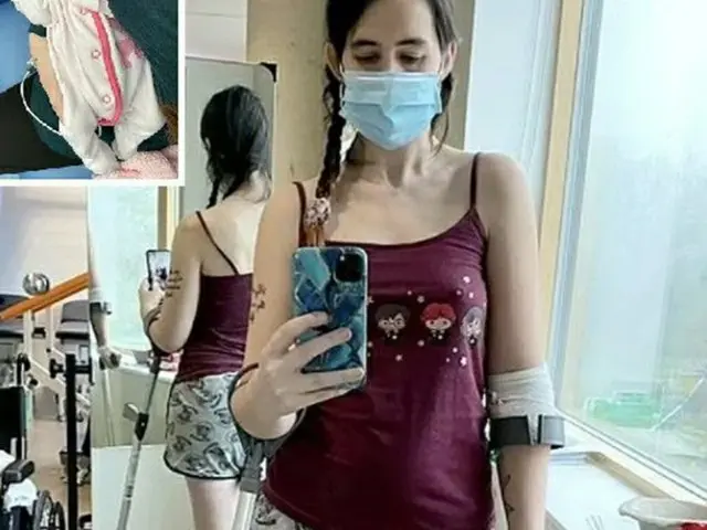 「お腹の中の赤ちゃんを失いたくない」…英国人女性が抗がん治療をあきらめて片足を切断した母性愛（画像提供:wowkorea）