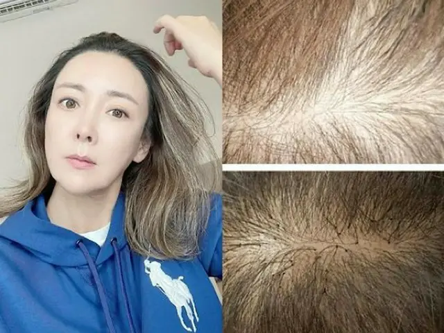 女優イ・サンア、増毛施術を告白、施術前後の写真公開...「最近はできないことがないね」（画像提供:wowkorea）