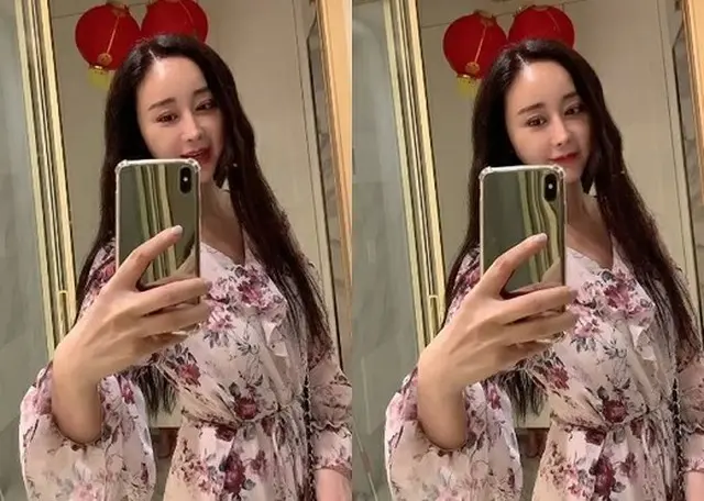 女優ハム・ソウォン、二重手術後の「経過」報告（画像提供:wowkorea）
