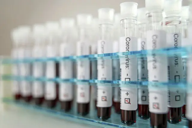 英大学の研究者ら、新型コロナ死亡リスクを倍増させる遺伝子発見＝韓国報道（画像提供:wowkorea）