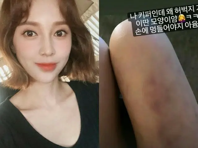 アユミ（伊藤ゆみ）、サッカーで太ももにあざ…「わたしゴールキーパーなのに」（画像提供:wowkorea）