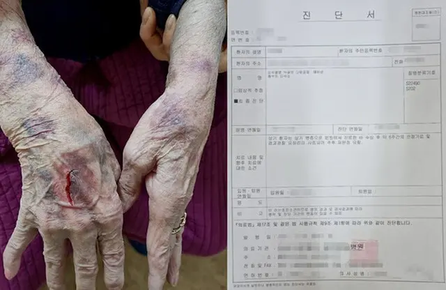 「骨折するほど」入所者に暴行…老人センター職員5人を立件＝韓国（画像提供:wowkorea）