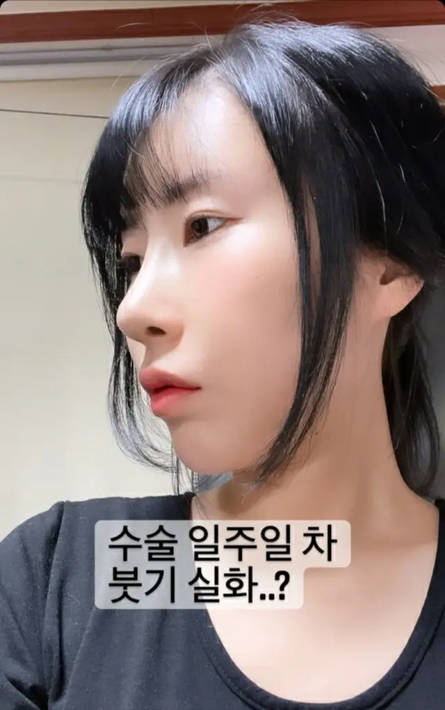 お笑い芸人のイ・セヨンが変わったビジュアルで目を引いた。（画像提供:wowkorea）