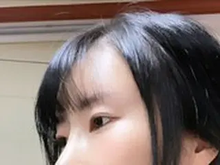 お笑い芸人イ・セヨン、鼻の整形手術後経過を公開「本当に一週目の腫れ？」