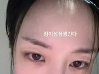 女優イ・ユビ、増えたほくろが気に入らない？…超接近自撮り写真で近況を公開