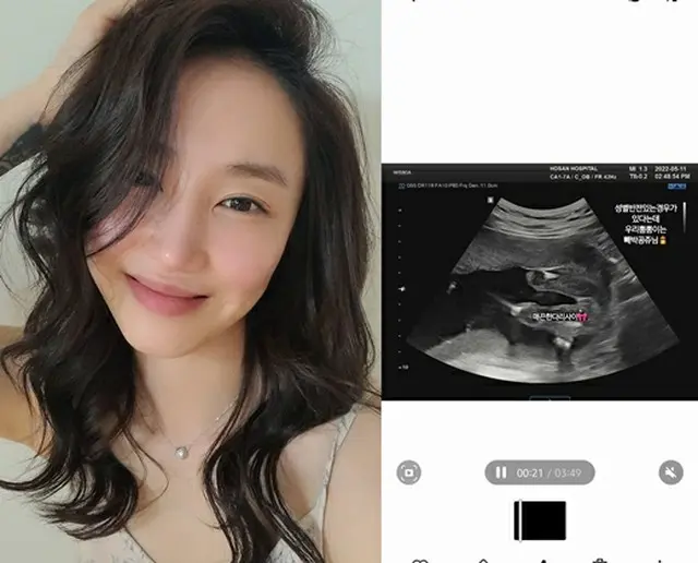 「天上智喜 The Grace」出身のSunday、2世の性別を公開「100パーセントお姫様…」（画像提供:wowkorea）