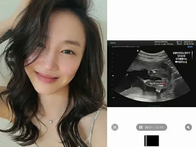 「天上智喜 The Grace」出身のSunday、2世の性別を公開「100パーセントお姫様…」（画像提供:wowkorea）