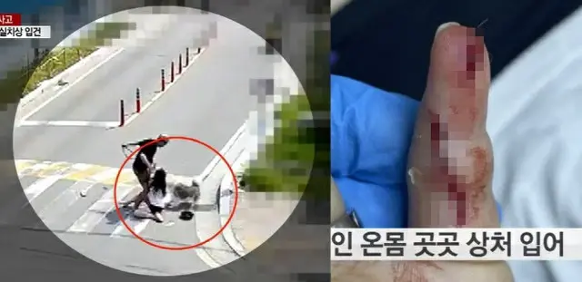 新婚夫婦を襲ったボーダー・コリー…妻とペットが負傷＝韓国江原道（画像提供:wowkorea）