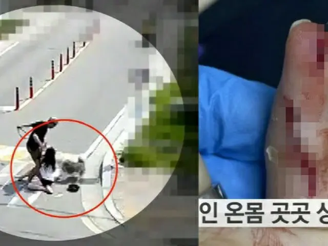 新婚夫婦を襲ったボーダー・コリー…妻とペットが負傷＝韓国江原道（画像提供:wowkorea）