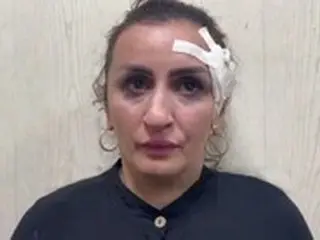「鼻の整形手術を受けるため」…45万円で新生児を売ったロシア人の女＝韓国報道