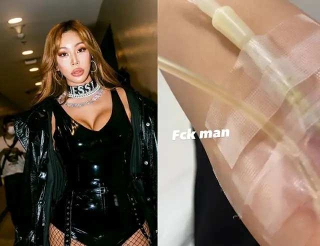 歌手Jessi、わずか1週間で再び病院行き（画像提供:wowkorea）